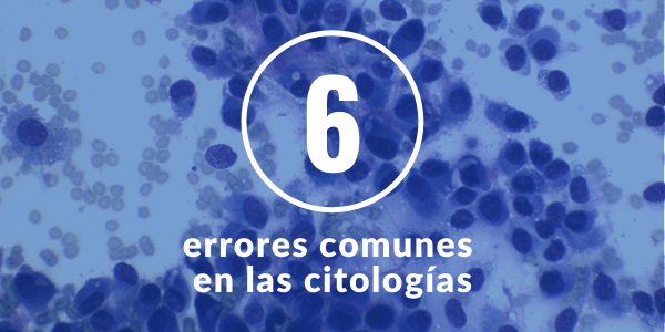 6 errores comunes en las citologías