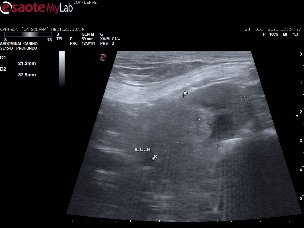 Las 3 preguntas que siempre me hacen sobre puciones ecoguiadas